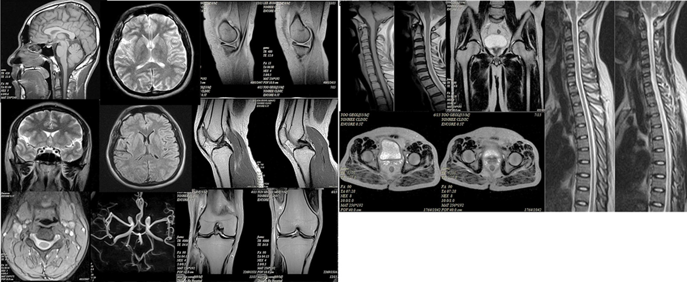 0.6T MRI
