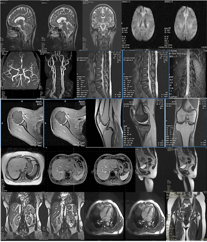 1.5T MRI