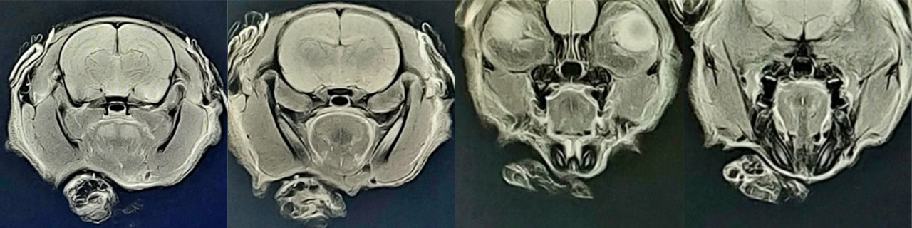 7.0T MRI
