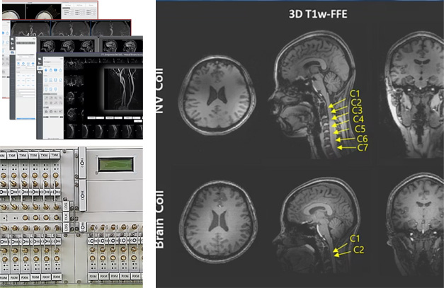 7.0T MRI